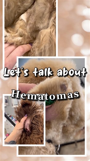 20K views · 2.8K reactions | Hematomas are not talked about often,...