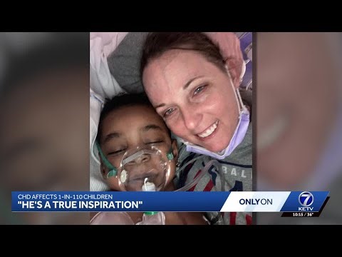 Foster Child, 4, Shows Up for Heart Surgery with No One by His Side. He Was Adopted by His Anesthesiologist