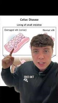 Celiac Disease Insights & Game-Changing Research for Gut Health, Abdominal Pain, fatigue And MORE!