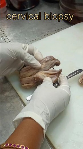 cervical biopsy sample processing 😞| #histopathology #satisfying #cervicaltreatment #cervicalcancer