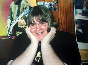 Woman with excess body hair from PCOS stops shaving