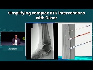 Simplifying complex BTK interventions with Oscar