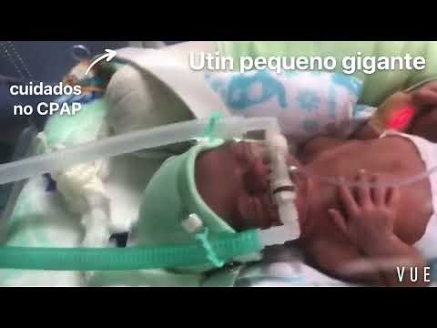 Cuidados no uso do CPAP nasal na UTI neonatal