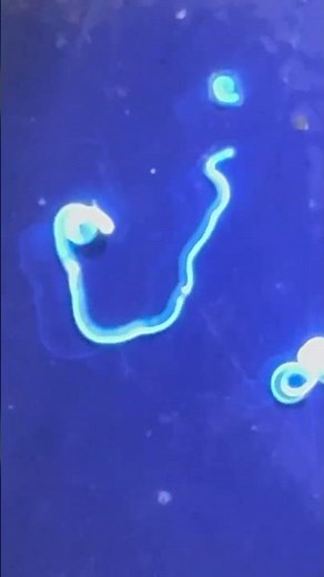 天然魚に多い寄生虫は当然ですが生きていますが、ほとんどは人体に無害。このアニサキスだけは話が変わり、非常に危険です。小さく糸のような形状ですが、これが胃の中に入ると壁に穴をあけ、激痛を引き起こします。
