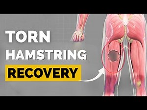 Hamstring Tear? How long you'll REALLY be out for. Do THIS Now! (Science-Backed)