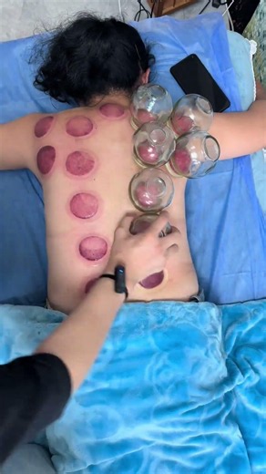 Immersive cupping for stress relief and relaxation