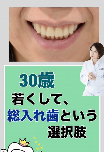 30代女性の総入れ歯治療の成功事例