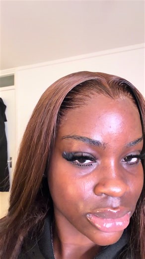 Understanding Tear Trough Filler Benefits