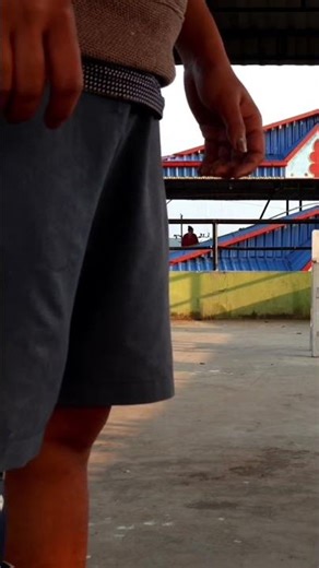 artificial leg (recovery update) #3r80 #explore #recoveryjourney #trendingshorts