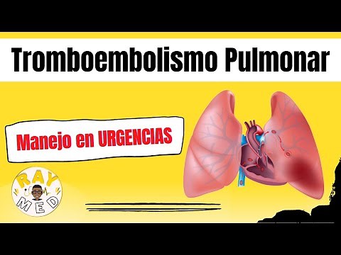 Pulmonary thromboembolism (definition, pathophysiology, and clinical presentation)