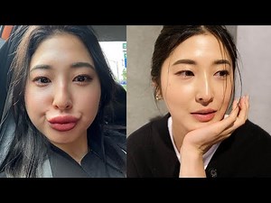 I'll tell you everything I did to my face.