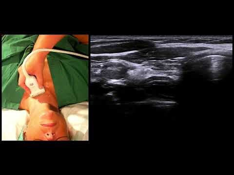 Airway Ultrasound