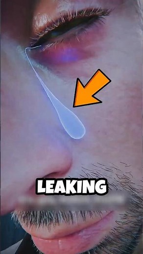 Where Do Tears Really Come From? 😢💧