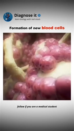Diagnose it on Instagram: "🩸 Ever wondered how your blood cells are made? . . This incredible process is called Hematopoiesis — the formation and development of all blood cells in your body. ❤️ It starts with hematopoietic stem cells in the bone marrow, which have the unique power to transform into red blood cells, white blood cells, and platelets. Every single day, your body produces hundreds of millions of new cells through this process — replacing old ones and keeping you alive and healthy. 