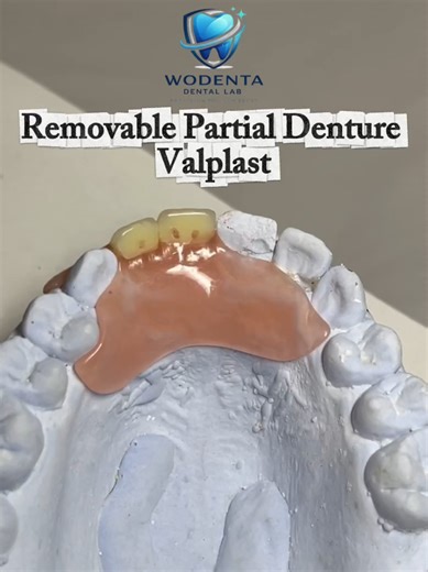 Goodbye, missing teeth! ✨ With Valplast, dentures are now more comfortable, lightweight, and a perfect fit. No metal clasps, it feels so natural! 🦷💪 #dentallabsidoarjo #wodentadentallab #valplast #doktergigi #teknikergigi