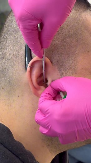 237K views · 1.2K reactions | Tragus piercing férfinak?!﫣 Természetesen! Ritkán érkeznek a férfiak tragus piercing szúrásra, inkább a helix az elterjedtebb, pedig egy tragus is mennyire jól áll bárkinek拾✨ Ha eddig te is gondolkoztál rajta, akkor itt az ideje bejelentkezni: www.fulcimpalyukasztas.hu/#idopont #poórnétünde #piercing #inspiració #traguspiercing #tragus #reels | Fülbelövés - Piercing Poór Tünde | Facebook