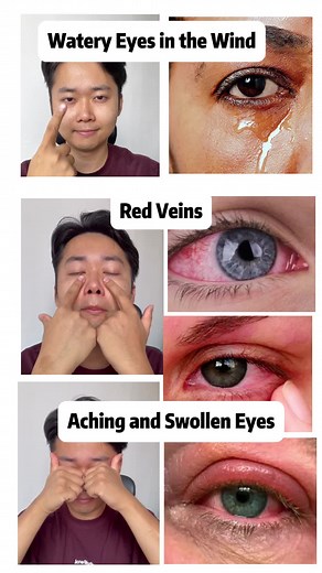 Cuidado de los ojos: ¡Prueba ahora mismo!