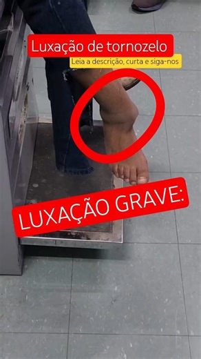 🚨 LUXAÇÃO DE TORNOZELO: Tornozelo Saiu do Lugar? Sintomas e Dor Intensa #enfermagem #short #shorts