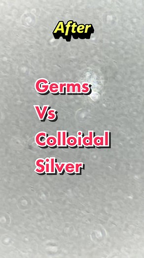 Germs vs Colloidal Silver: Safety and Effects Explained