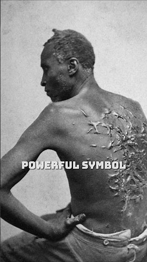 Black Slave Shows Off Horrific Whipping Scars on His Back #story