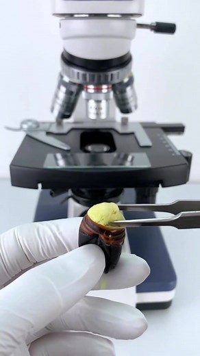 Microscope: Unveiling the Sea Urchin's World