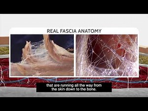 What is "Cellulite"? Fascia explained