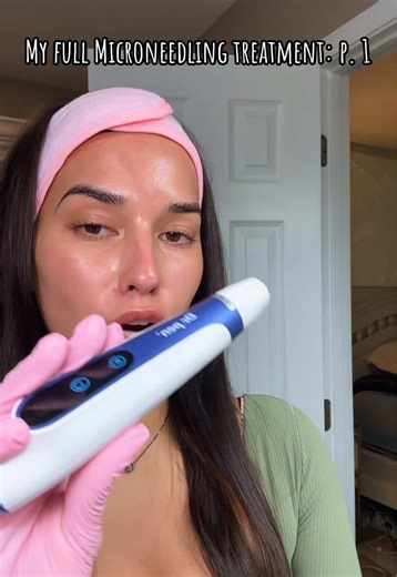 Mircroneedling pokes fine holes in the skin and creates collagen formation in the healing process of the fine holes that were created, thereby increasing skin elasticity. #healthcare #prp #prpmicroneedlingfacial #microneedlingface everything is 🔗 in bio