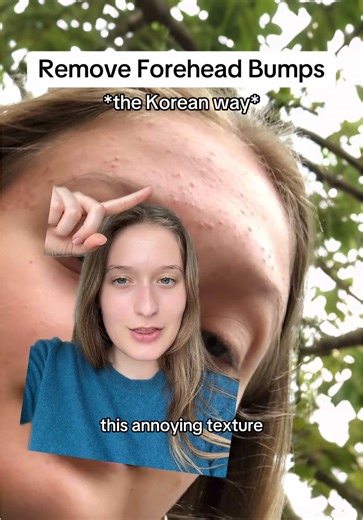 Melody |Ancient Beauty Secrets (@melodyyaslan) - Korean secret to remove forehead texture 👀 This one step after cleansing helps keep my acne-prone forehead skin smooth and bump-free & it’s the Ji Woo Gae Heartleaf BHA Peeling Pad from the Korean Brand Celimax ✨ #celimax #koreanskincare #naturalskincare #forehead #acne #clearskin #celimaxpartner