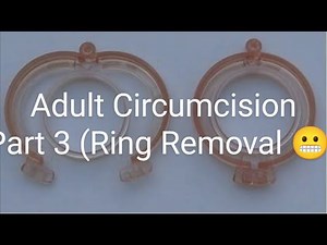 Shang Ring Circumcision pt.3 (Ring Removal)