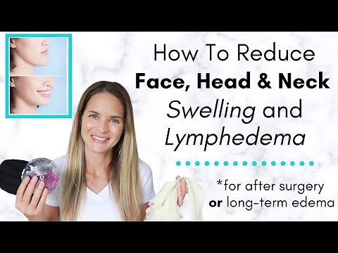 How to Reduce Neck and Face Swelling After a Surgery or Lymphedema : By a Physical Therapist