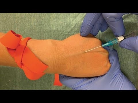 Intravenous (IV) Cannulation Step-by-Step Guide