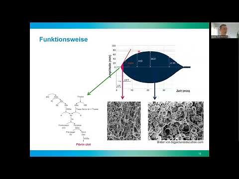 Fasttrack Video - ROTEM® / TEG® ganz einfach erklärt (von Prof. Wolf Hautz)