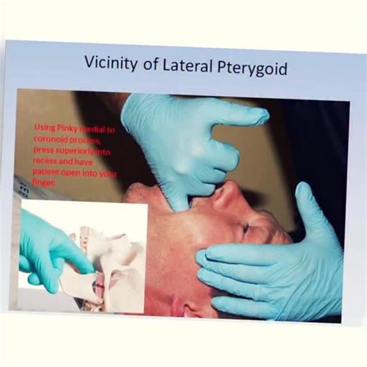 To release/stretch the lateral pterygoid try this. NKT would then activate the contralateral lateral pterygoid, QL, etc. https://www.youtube.com/watch?v=jtPJwo2qZRw (Link in profile). #nkt #neurokinetictherapy #jaw #tmj #pterygoid | NeuroKinetic Therapy