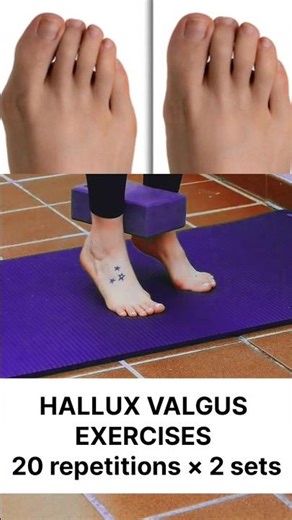 HALLUX VALGUS EXERCISES👍#shorts #exercise #motivation