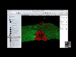 RCM / Easy & intuitive confocal super-resolution with the RCM & Volocity software Webinar July 2020