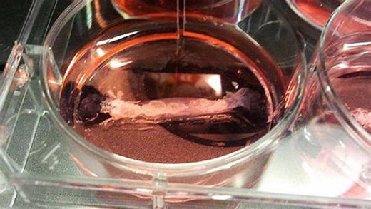 Five US states have now banned lab-grown meat