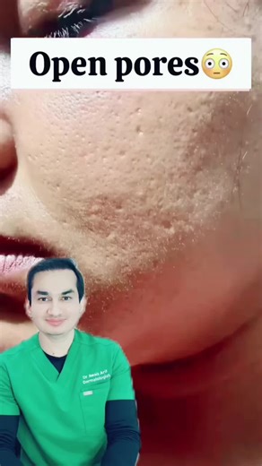 Effective Solutions for Open Pores