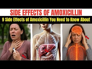 9 Side Effects of Amoxicillin You Need to Know About (Doctors Never Say This)