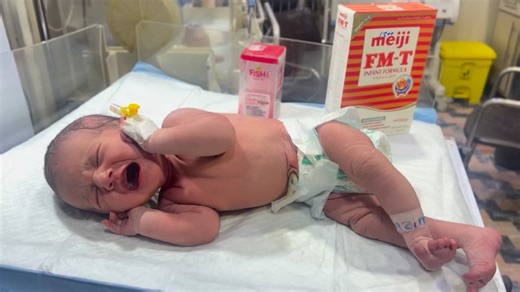 How to Take Feeding in the NICU | Step-by-Step Newborn Feeding Guide #viral #shorts #foryou #cutebaby #niculife | Anoop Gautam