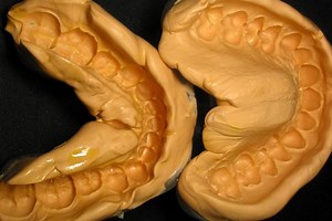 How To Take Great Dental Impressions