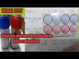 Widal Dilution test || Quantitative Widal test by slide method || Typhoid test करना सीखे||