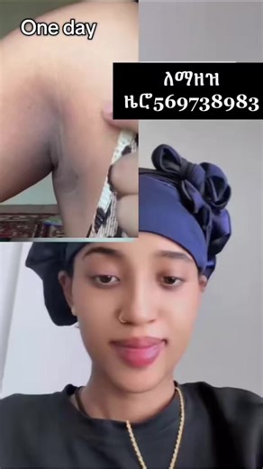 Hair Growth with Shea Butter & Minoxidil