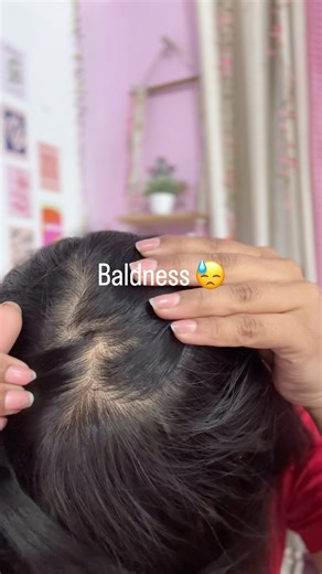 My hair journey wasn’t easy, but this homemade hair mask changed everything ✨#naturalbeautywithriya