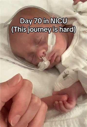 Day 70 in NICU: A Preemie's Journey of Strength