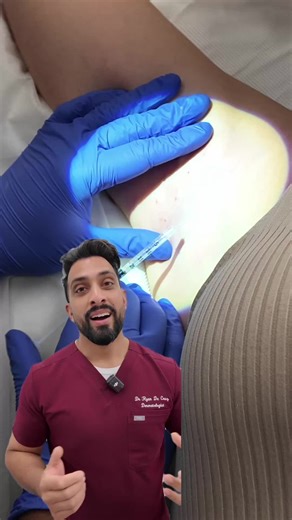 Tired of excessive sweating? We can help! 💦 During these warmer months, it’s not uncommon to find yourself sweating a little more than usual. But for some, excessive sweating (