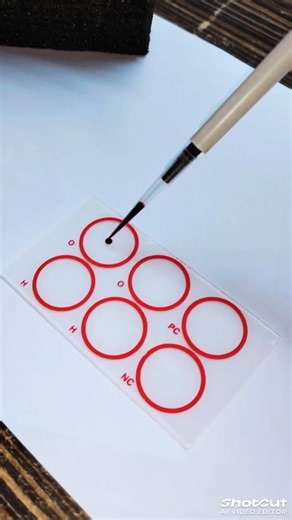 which group ... #histocompati #copynumbervariation #structuralvariants #cytogenetics #bloodgrouping