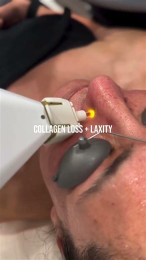 Skin aging is multifactorial