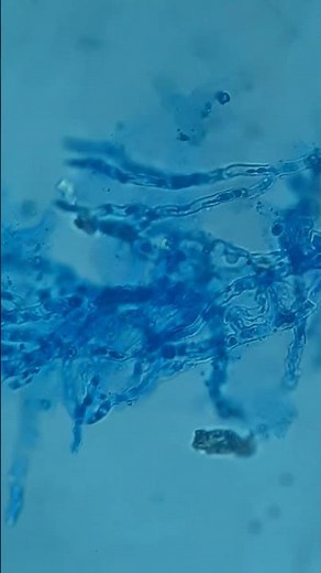 Aspergillus niger hyphae and mycelium #fungalinfection #shorts