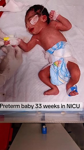 33-Week Preterm Baby in NICU: Tiny Fighter's Journey