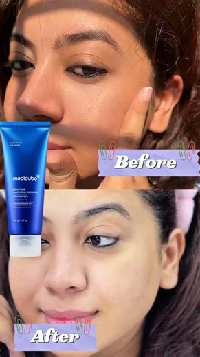 119 reactions · 11 comments | Medicube Zero Pore Blackhead Mud Mask...